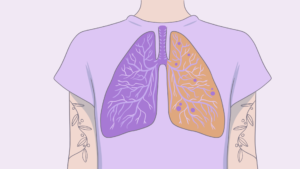 marijuana and gaht health impacts on lungs and more