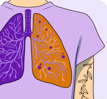 Illustration of a person’s chest with stylized lungs overlaying their shirt